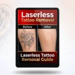 Laserless Tattoo Removal Review (Does It Really Work or Just Hype?)