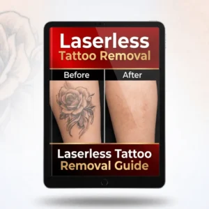 Read more about the article Laserless Tattoo Removal Review (Does It Really Work or Just Hype?)